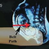 seat belt path pregnancy